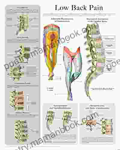 Low Back Pain E Chart: Quick Reference Guide